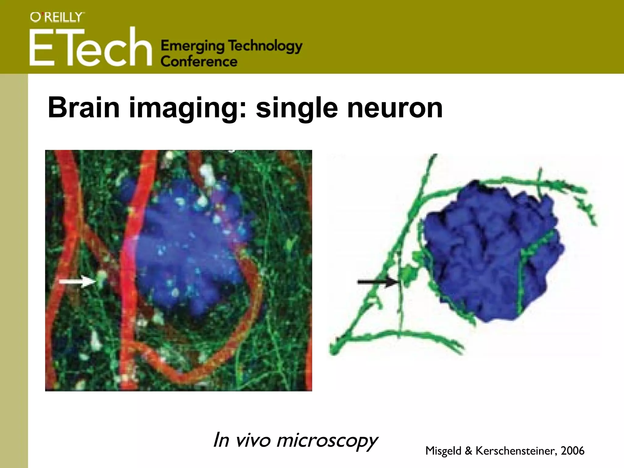 Brain imaging: single neuron Misgeld &  Kerschensteiner,  2006 In vivo microscopy 