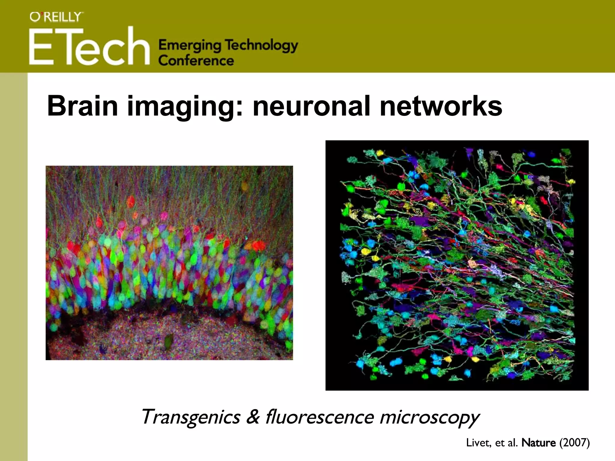 Brain imaging: neuronal networks Livet, et al.  Nature  (2007) Transgenics & fluorescence microscopy   
