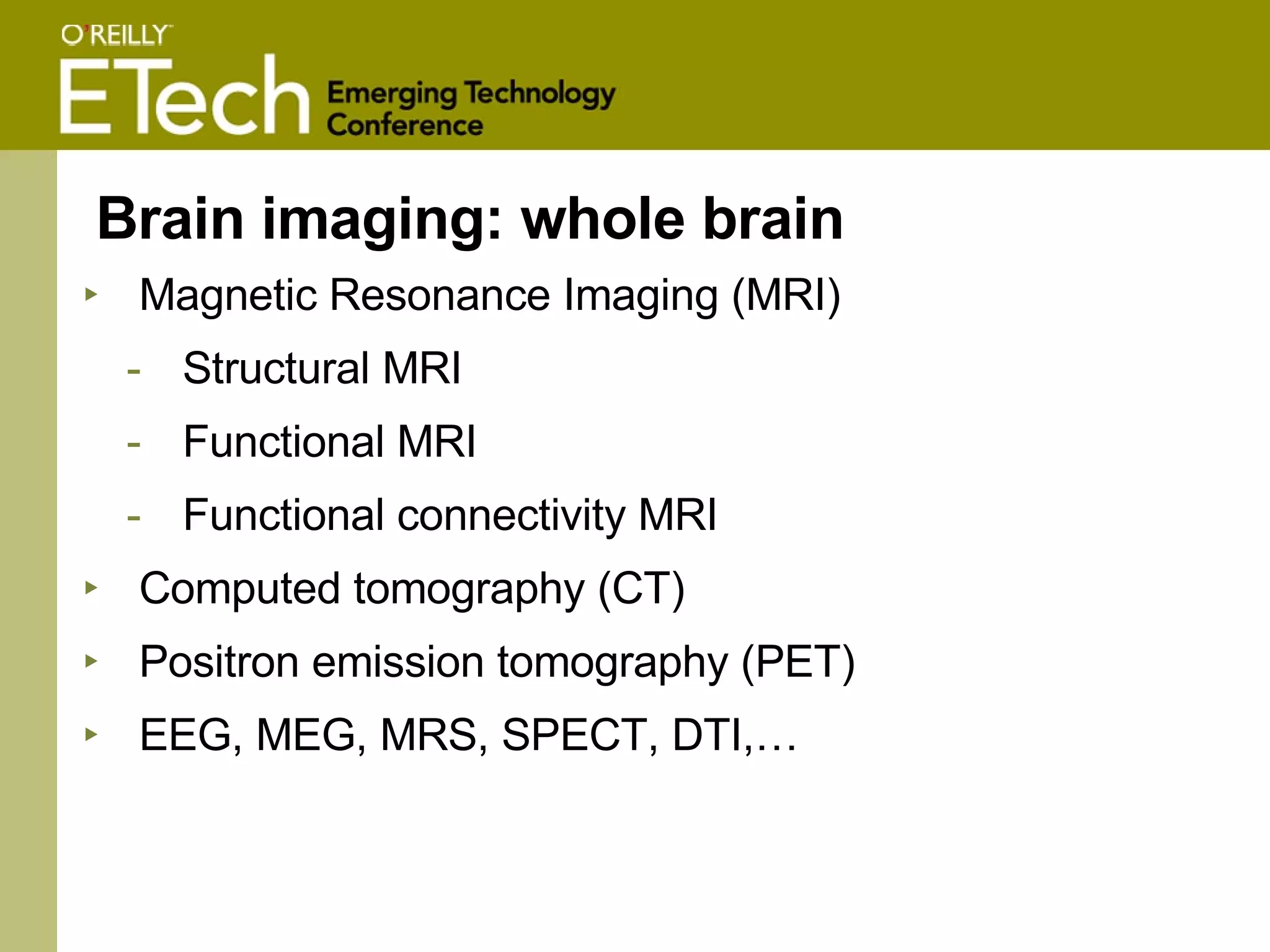 Brain imaging: whole brain Magnetic Resonance Imaging (MRI) Structural MRI Functional MRI Functional connectivity MRI Computed tomography (CT) Positron emission tomography (PET) EEG, MEG, MRS, SPECT, DTI,… 