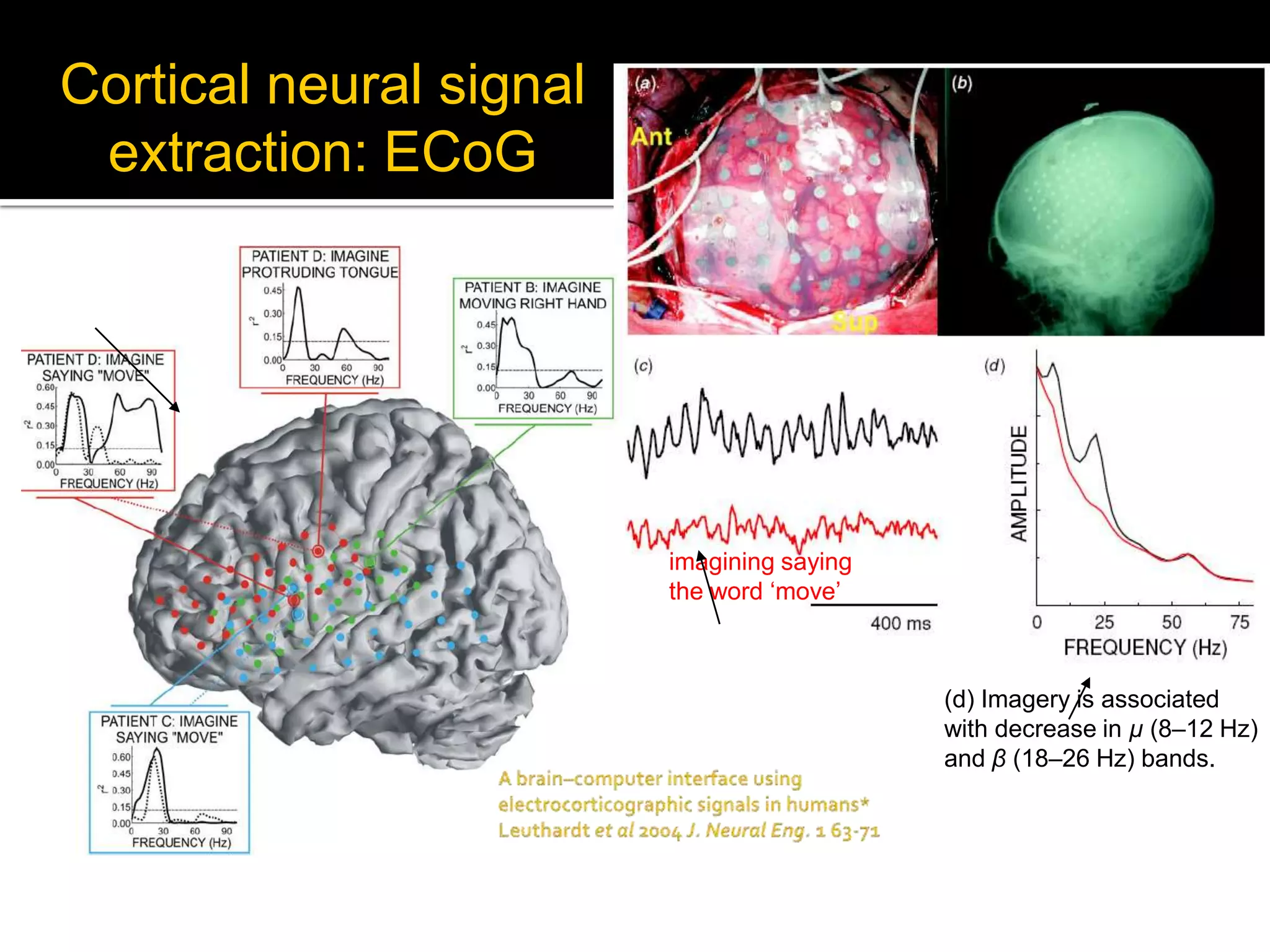 Cortical neural signal extraction: ECoGrestingimagining saying the word ‘move’(d) Imagery is associated with decrease in µ (8–12 Hz) and β (18–26 Hz) bands.A brain–computer interface using electrocorticographic signals in humans*Leuthardt et al 2004 J. Neural Eng. 1 63-71 