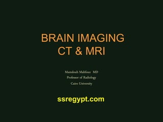 BRAIN IMAGING
CT & MRI
Mamdouh Mahfouz MD
Professor of Radiology
Cairo University
ssregypt.com
 