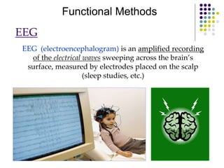 Functional Methods
EEG (electroencephalogram) is an amplified recording
of the electrical waves sweeping across the brain’s
surface, measured by electrodes placed on the scalp
(sleep studies, etc.)
EEG
 
