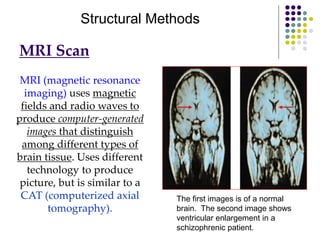 MRI Scan
MRI (magnetic resonance
imaging) uses magnetic
fields and radio waves to
produce computer-generated
images that distinguish
among different types of
brain tissue. Uses different
technology to produce
picture, but is similar to a
CAT (computerized axial
tomography).
The first images is of a normal
brain. The second image shows
ventricular enlargement in a
schizophrenic patient.
Structural Methods
 