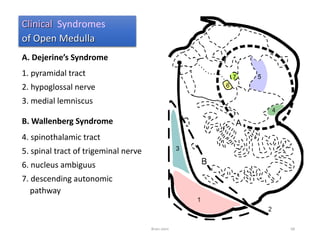 A. Dejerine’s Syndrome
1. pyramidal tract
2. hypoglossal nerve
3. medial lemniscus
B. Wallenberg Syndrome
4. spinothalamic tract
5. spinal tract of trigeminal nerve
6. nucleus ambiguus
7. descending autonomic
pathway
Clinical Syndromes
of Open Medulla
Brain stem 68
 