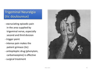 Trigeminal Neuralgia
(tic douloureux)
- excruciating episodic pain
in the area supplied by
trigeminal nerve, especially
second and third division
- trigger point
- intense pain makes the
patient grimace (tic)
- antiepileptic drug (phenytoin,
carbamazepine) is effective
- surgical treatment
Brain stem 92
 