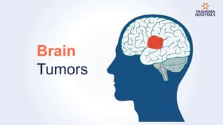 Brain
Tumors
 