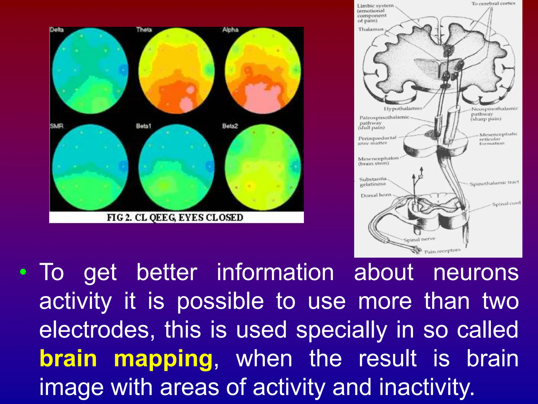 • To get better information about neurons
activity it is possible to use more than two
electrodes, this is used specially in so called
brain mapping, when the result is brain
image with areas of activity and inactivity.
 