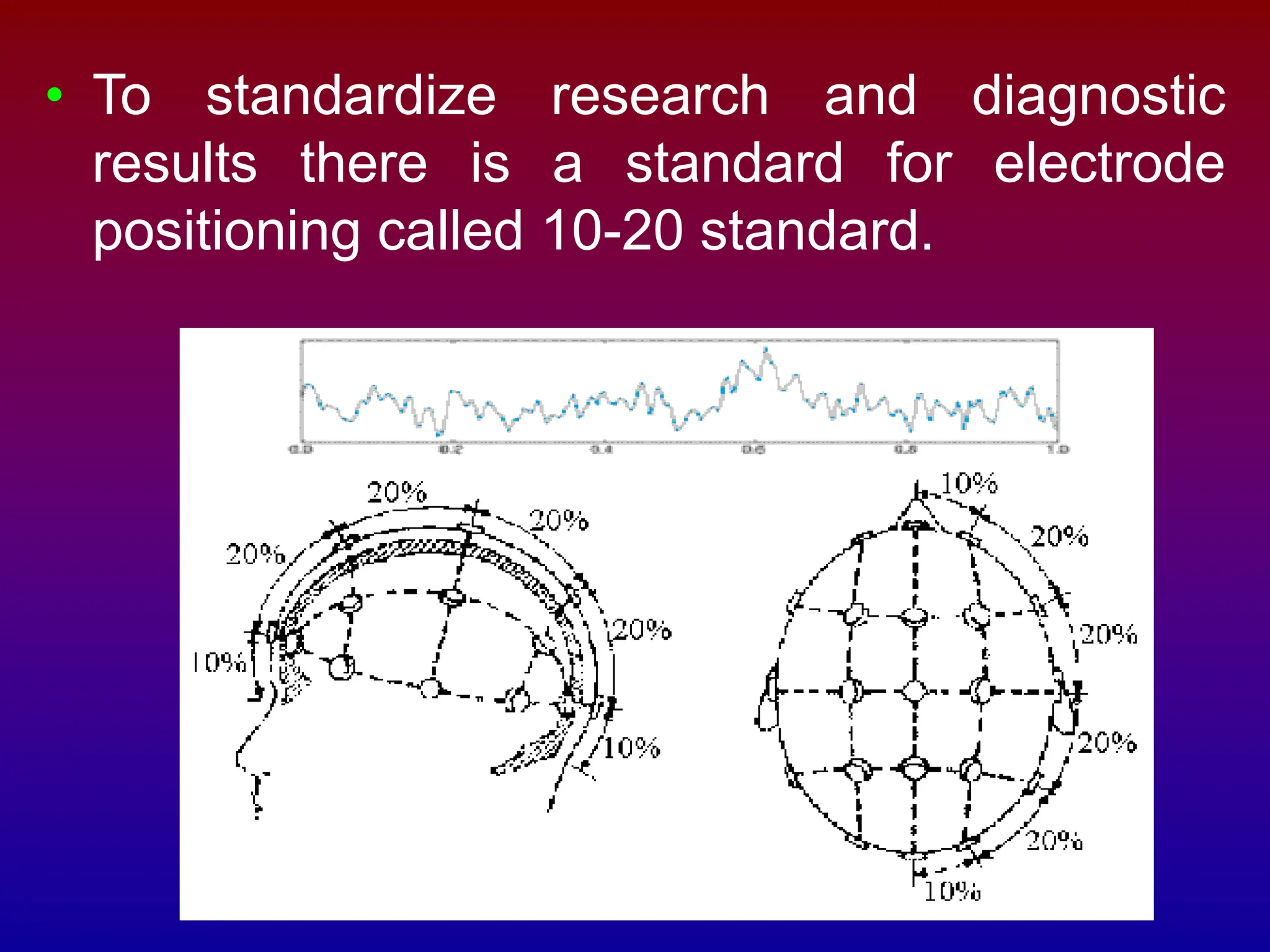 • To standardize research and diagnostic
results there is a standard for electrode
positioning called 10-20 standard.
 