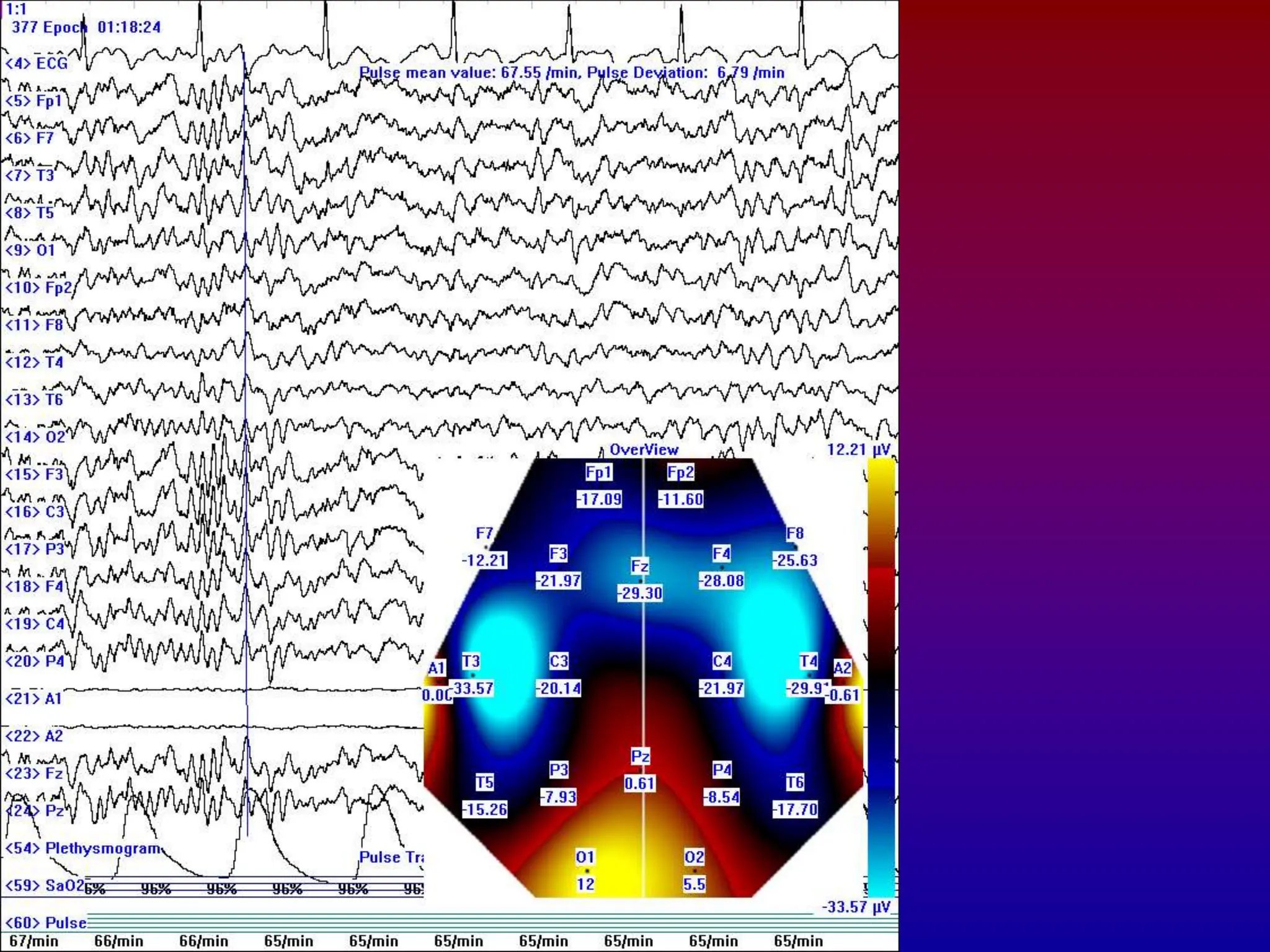 AI on brain - waves activity ppt4916.ppt