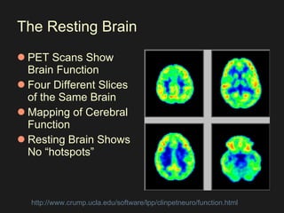 The Resting Brain PET Scans Show Brain Function Four Different Slices of the Same Brain Mapping of Cerebral Function Resting Brain Shows No “hotspots” http://www.crump.ucla.edu/software/lpp/clinpetneuro/function.html   