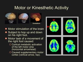 Motor or Kinesthetic Activity Motor stimulation of the brain Subject to hop up and down on his right foot.  Motor task of a movement of the right foot caused: Cortical metabolic activation of the left motor strip (horizontal arrowhead) Caused supplementary motor cortex (vertical arrow, top).      Cerebellum 