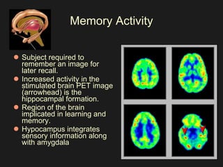 Memory Activity Subject required to remember an image for later recall. Increased activity in the stimulated brain PET image (arrowhead) is the hippocampal formation.  Region of the brain implicated in learning and memory.  Hypocampus integrates sensory information along with amygdala 