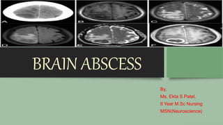 BRAIN ABSCESS
By,
Ms. Ekta S Patel,
II Year M.Sc Nursing
MSN(Neuroscience)
 