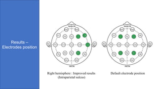 Results –
Electrodes position
Right hemisphere : Improved results
(Intraparietal sulcus)
Default electrode position
 