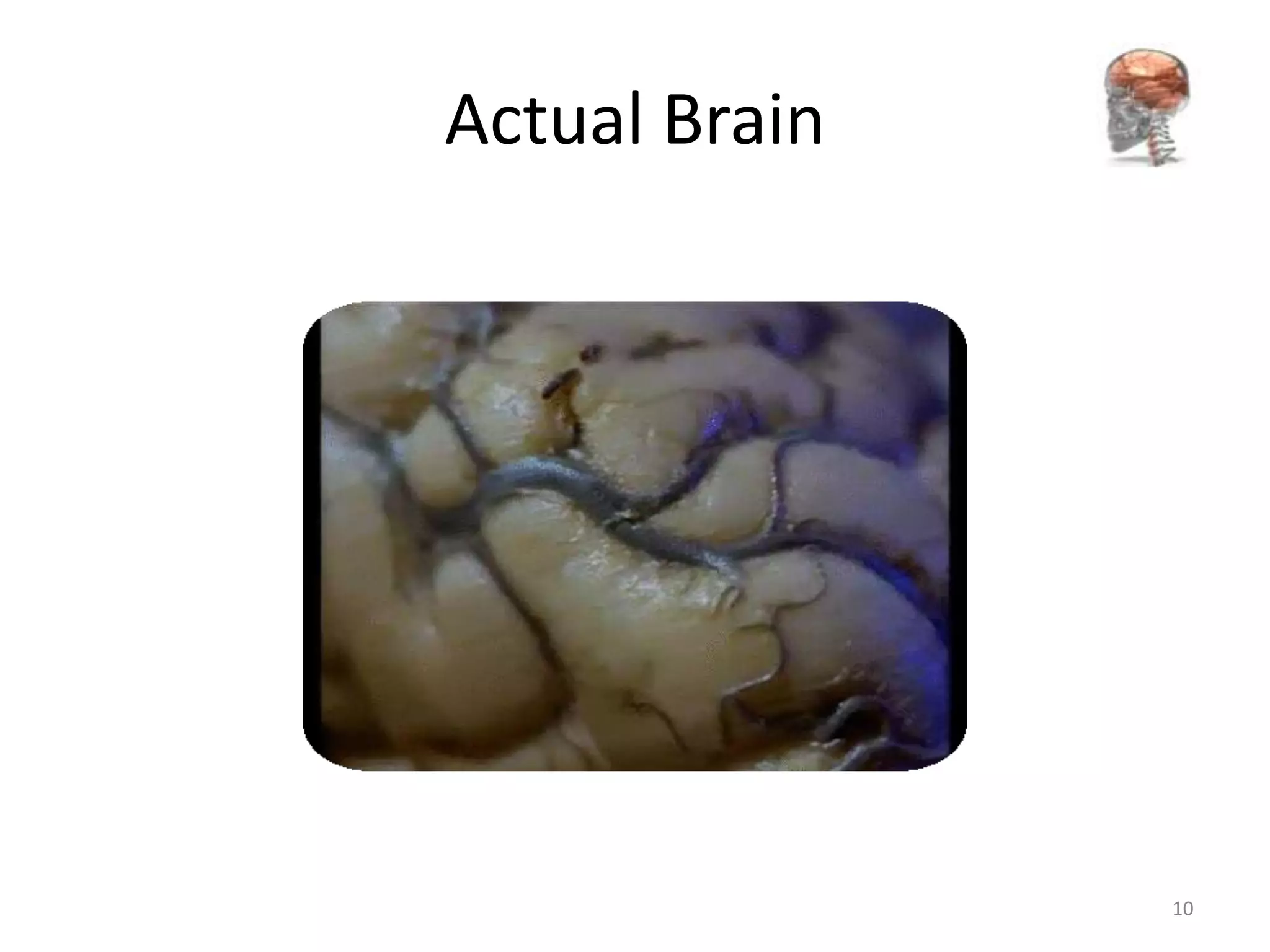 Actual Brain




               10
 