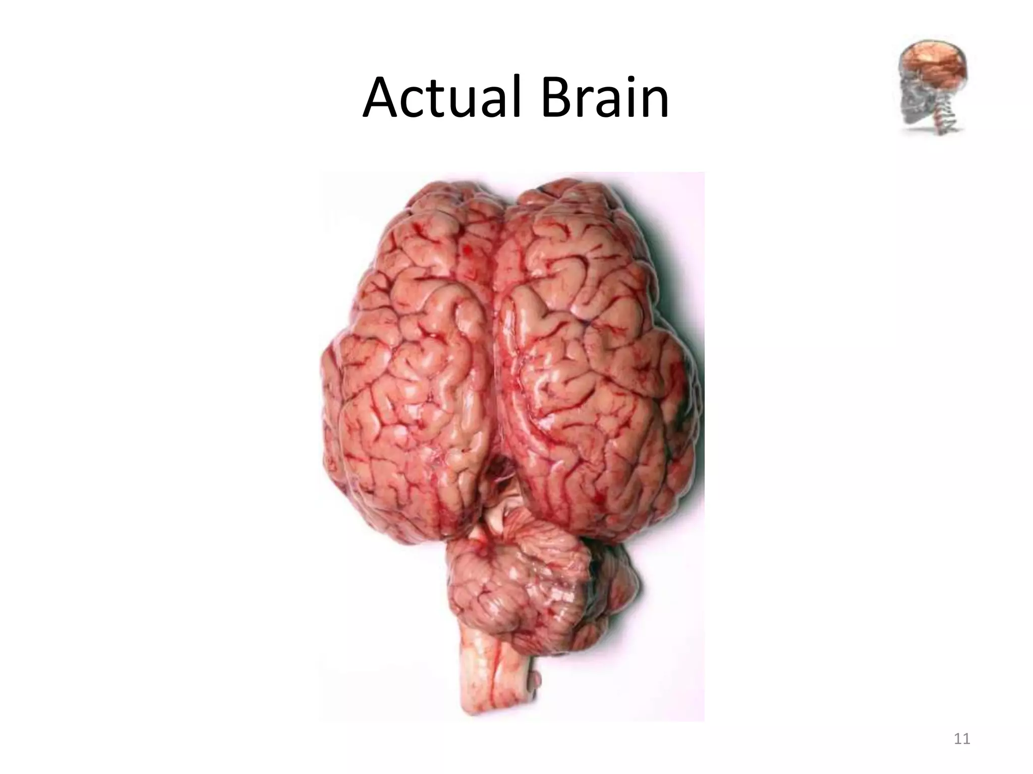 Actual Brain




               11
 