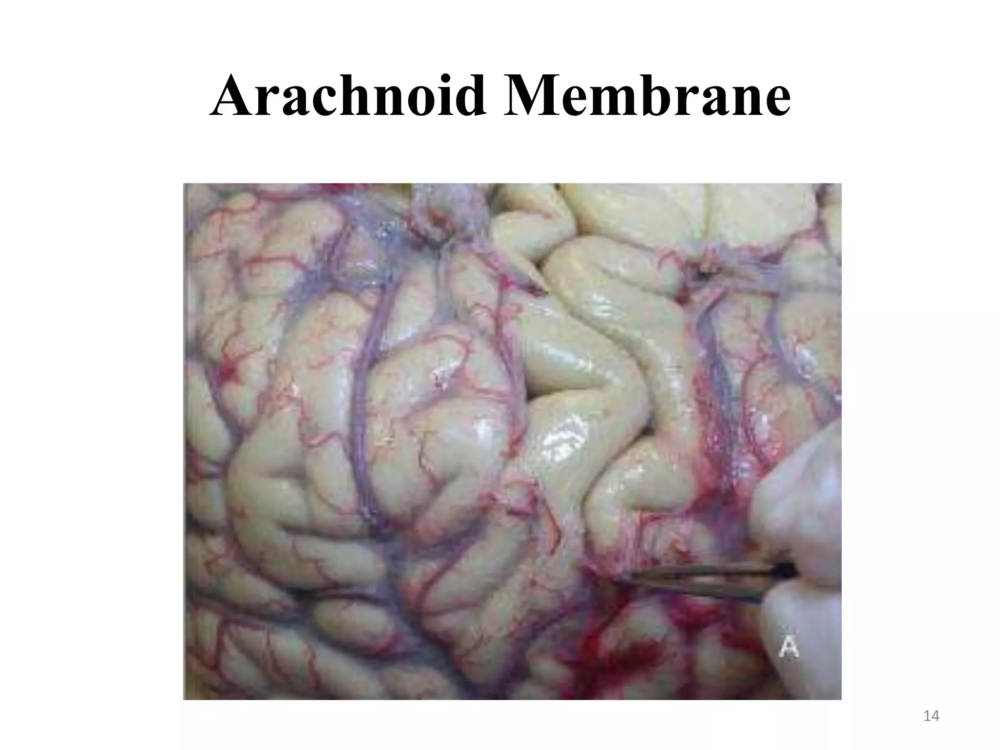 Arachnoid Membrane




                     14
 