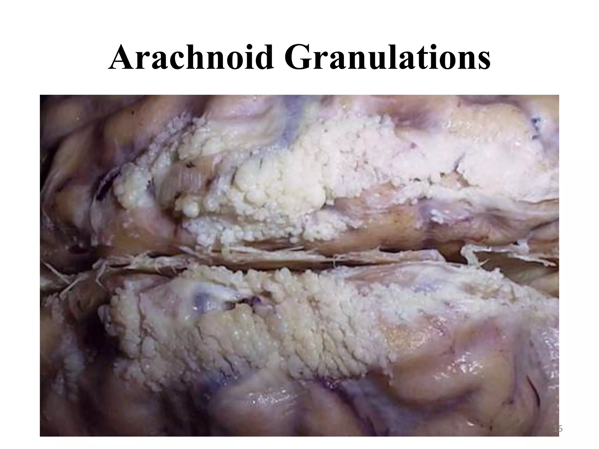 Arachnoid Granulations




                         15
 