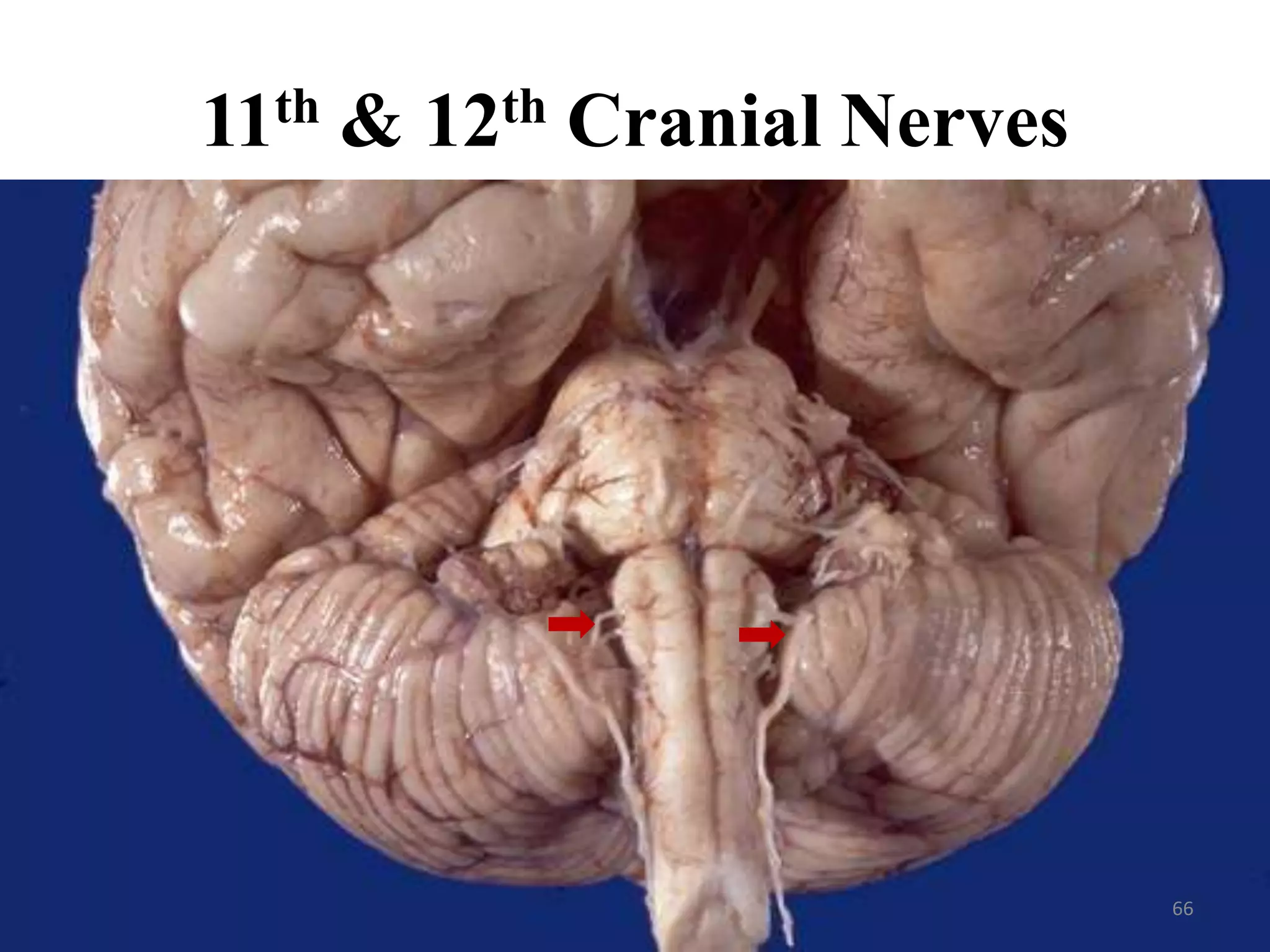 11th & 12th Cranial Nerves




                             66
 