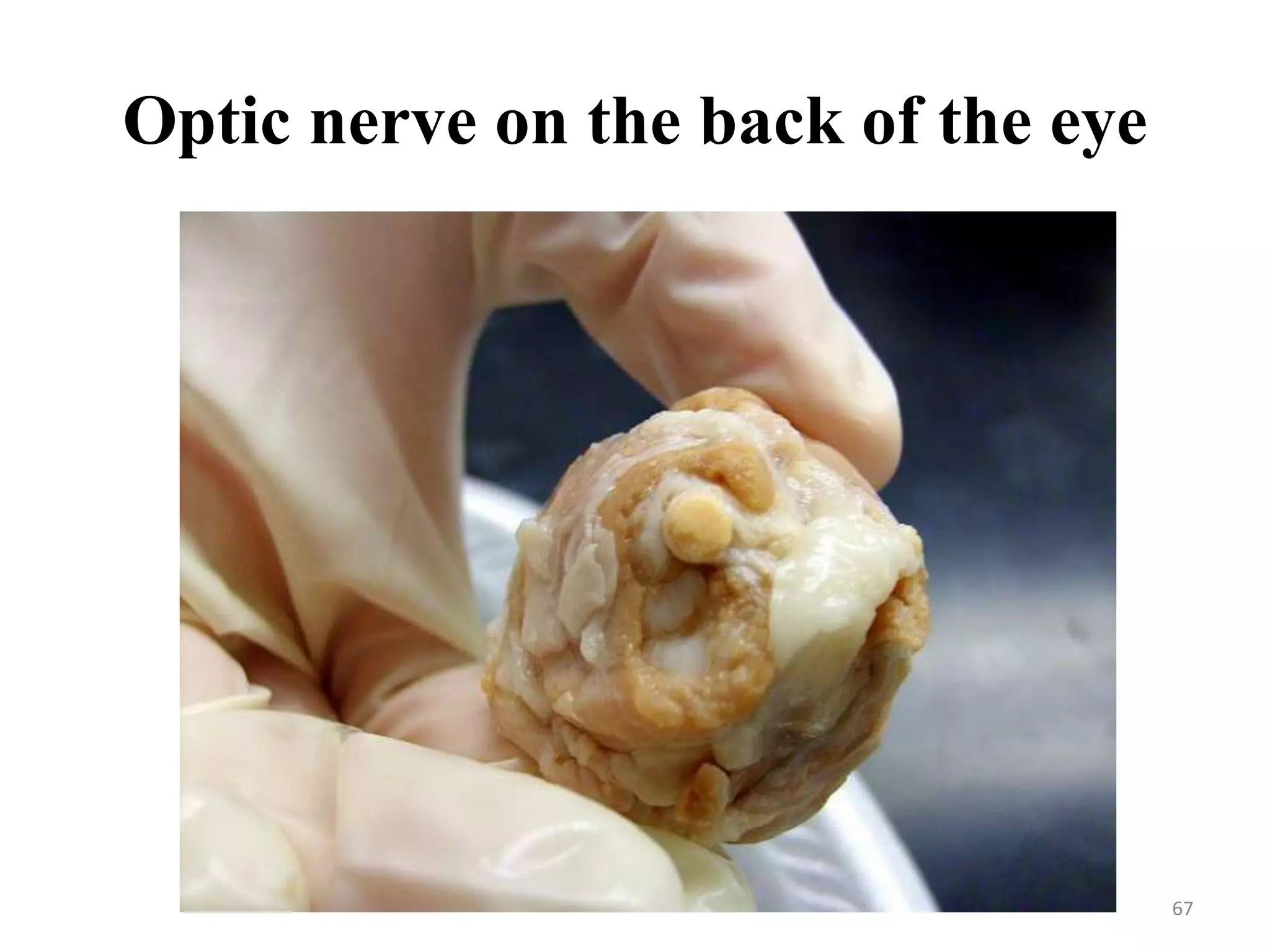 Optic nerve on the back of the eye




                                     67
 