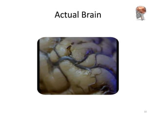 Actual Brain




               10
 