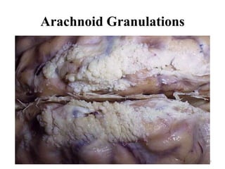 Arachnoid Granulations




                         15
 