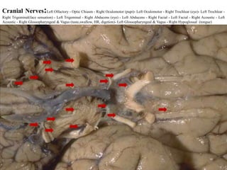 Cranial Nerves:Left Olfactory - Optic Chiasm - Right Oculomotor (pupi)- Left Oculomotor - Right Trochlear (eye)- Left Trochlear -
Right Trigeminal(face sensation) - Left Trigeminal - Right Abducens (eye) - Left Abducens - Right Facial - Left Facial - Right Acoustic - Left
Acoustic - Right Glossopharyngeal & Vagus (taste,swallow, HR, digetion)- Left Glossopharyngeal & Vagus - Right Hypoglossal (tongue)




                                                                                                                                    65
 