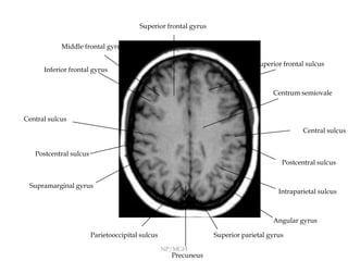 Anatomy of brain sulcus and gyrus - Dr.Sajith MD RD | PPTX