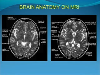 Cardunculus Brain Brain anatomy | PPT