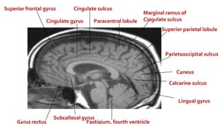 Marginal Ramus Brain Anatomy.pptx