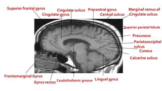 Marginal Ramus Brain Anatomy.pptx
