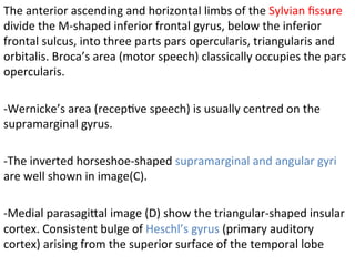 The	anterior	ascending	and	horizontal	limbs	of	the	Sylvian	ﬁssure	
divide	the	M-shaped	inferior	frontal	gyrus,	below	the	inferior	
frontal	sulcus,	into	three	parts	pars	opercularis,	triangularis	and	
orbitalis.	Broca’s	area	(motor	speech)	classically	occupies	the	pars	
opercularis.		
	
-Wernicke’s	area	(recepHve	speech)	is	usually	centred	on	the	
supramarginal	gyrus.	
	
-The	inverted	horseshoe-shaped	supramarginal	and	angular	gyri	
are	well	shown	in	image(C).	
	
-Medial	parasagiTal	image	(D)	show	the	triangular-shaped	insular	
cortex.	Consistent	bulge	of	Heschl’s	gyrus	(primary	auditory	
cortex)	arising	from	the	superior	surface	of	the	temporal	lobe
 