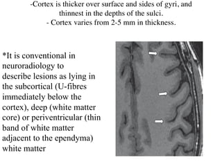 -Cortex is thicker over surface and sides of gyri, and
thinnest in the depths of the sulci.
- Cortex varies from 2-5 mm in thickness.
*It is conventional in
neuroradiology to
describe lesions as lying in
the subcortical (U-fibres
immediately below the
cortex), deep (white matter
core) or periventricular (thin
band of white matter
adjacent to the ependyma)
white matter
 