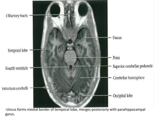 -Uncus	forms	medial	border	of	temporal	lobe,	merges	posteriorly	with	parahippocampal	
gyrus.	
 