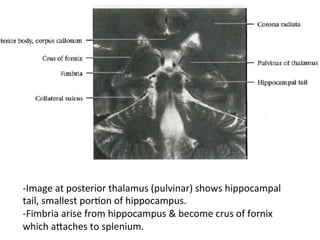 -Image	at	posterior	thalamus	(pulvinar)	shows	hippocampal	
tail,	smallest	porHon	of	hippocampus.		
-Fimbria	arise	from	hippocampus	&	become	crus	of	fornix	
which	aTaches	to	splenium.	
 