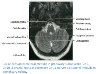 -CN12	exits	anterolateral	medulla	in	preolivary	sulcus	while		CN9,	
CN10,	&	cranial	roots	of	accessory	CN	11	nerves	exit	lateral	medulla	in	
postolivary	sulcus.	
mid	medulla	
 