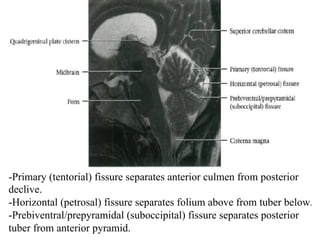 -Primary (tentorial) fissure separates anterior culmen from posterior
declive.
-Horizontal (petrosal) fissure separates folium above from tuber below.	
-Prebiventral/prepyramidal (suboccipital) fissure separates posterior
tuber from anterior pyramid.
 