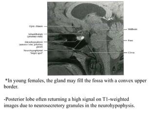 *In young females, the gland may fill the fossa with a convex upper
border.
-Posterior lobe often returning a high signal on T1-weighted
images due to neurosecretory granules in the neurohypophysis.
 