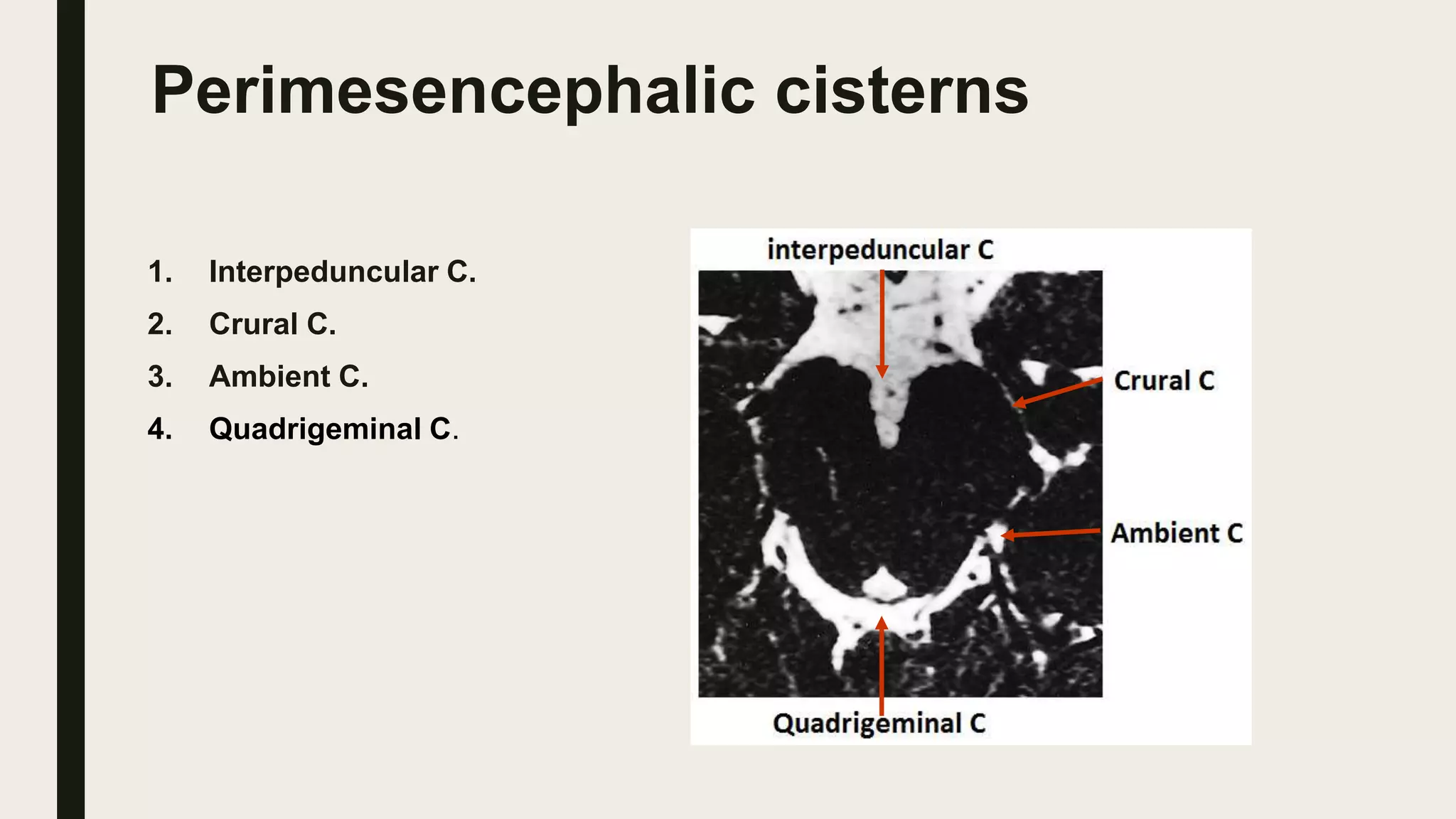 Perimesencephalic cisterns
1. Interpeduncular C.
2. Crural C.
3. Ambient C.
4. Quadrigeminal C.
 