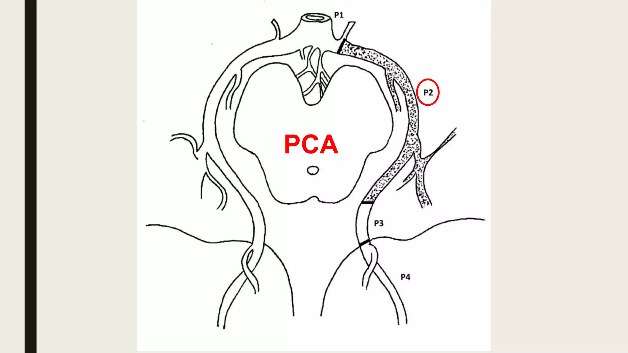 PCA
 