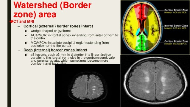 Brain anatomy (part 4)