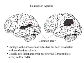 Brain And Aphasia | PPT