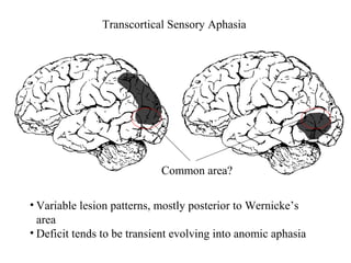 Brain And Aphasia | PPT