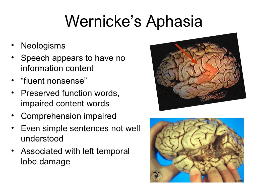 Brain And Aphasia