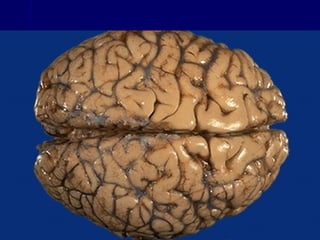 Brain and cranial nerves | PPT