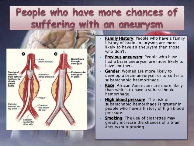 Brain Aneurysm