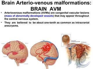 Avm Child Brain avm | PPT