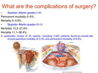 What are the complications of surgery?
• Spetzler–Martin grades I–III:
Permanent morbidity 0–5%.
Mortality 0–3.9%.
• Spetzler–Martin grades IV–V:
Morbidity 12.2–21.9%.
Mortality 11.1–38.4%.
A systematic review of 25 reports, including 2,425 patients, found an overall rate
of post-operative mortality of 3.3% and permanent morbidity of 8.6%.
 