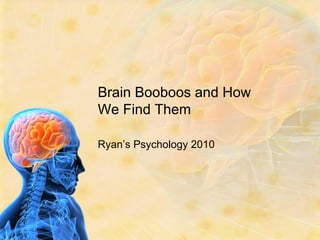 Brain Booboos and How
We Find Them

Ryan’s Psychology 2010
 