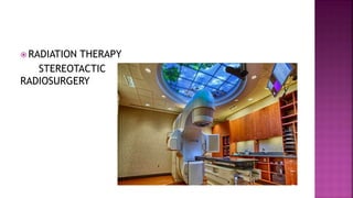  RADIATION THERAPY
STEREOTACTIC
RADIOSURGERY
 